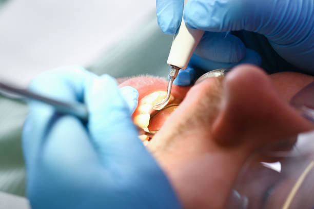 Best Emergency Dentist for Lost Fillings or Crowns in Cactus, TX