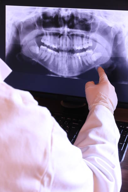 Best Emergency Dentist for Lost Fillings or Crowns in Cactus, TX
